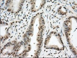 Phosphodiesterase 4A/PDE4A Antibody (OTI1C8), Novus Biologicals 0.1mL;