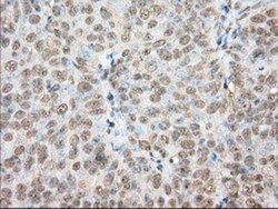 Phosphodiesterase 4A/PDE4A Antibody (OTI1C8), Novus Biologicals 0.1mL;