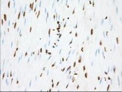 Phosphodiesterase 4A/PDE4A Antibody (OTI1C8), Novus Biologicals 0.1mL;