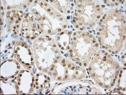 Phosphodiesterase 4A/PDE4A Antibody (OTI1C8), Novus Biologicals 0.1mL;