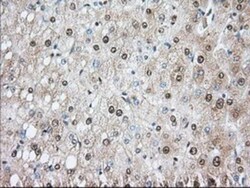 Phosphodiesterase 4A/PDE4A Antibody (OTI1C8), Novus Biologicals 0.1mL;