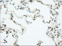Phosphodiesterase 4A/PDE4A Antibody (OTI1C8), Novus Biologicals 0.1mL;