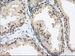 Phosphodiesterase 4A/PDE4A Antibody (OTI1C8), Novus Biologicals 0.1mL;