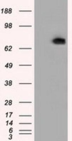 Phosphodiesterase 4A/PDE4A Antibody (OTI1C8), Novus Biologicals 0.1mL;