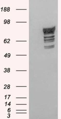 Phosphodiesterase 4D Antibody, Novus Biologicals 0.1mg; Unlabeled:Antibodies,