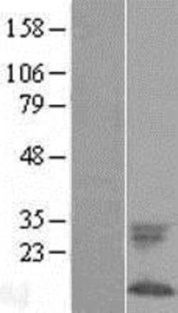 Novus Biologicals&trade;&nbsp;Phospholemman Overexpression Lysate