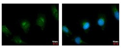 PLA2G4A Antibody, Novus Biologicals 0.1mL; Unlabeled:Antibodies, Polyclonal