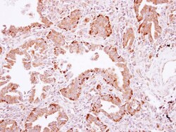 PLA2G4A Antibody, Novus Biologicals 0.1mL; Unlabeled:Antibodies, Polyclonal