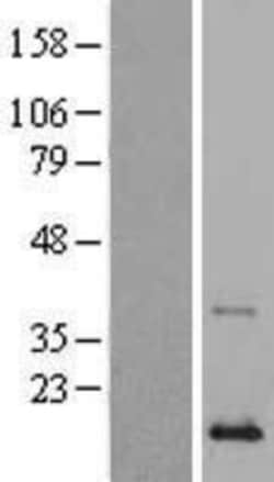 Novus Biologicals&trade;&nbsp;PLA2G2A Overexpression Lysate