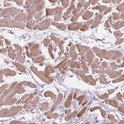Phospholipase A2 IIE Antibody, Novus Biologicals 0.1mL; Unlabeled:Antibodies,