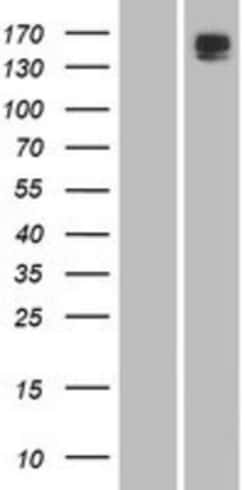 Novus Biologicals&trade;&nbsp;Phospholipase B1 Overexpression Lysate