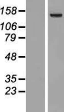 Novus Biologicals™ PLC-beta 4 Overexpression Lysate