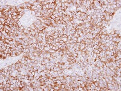 Phospholipase C delta 1 Antibody, Novus Biologicals 0.1mL; Unlabeled:Antibodies,