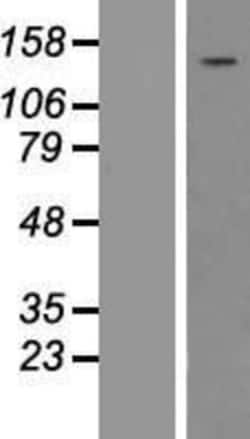 Novus Biologicals&trade;&nbsp;PLC-gamma 1 Overexpression Lysate