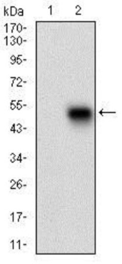Phospholipase A2 XII Antibody (3H2C11) - BSA Free, Novus Biologicals 0.025 mL | Buy Online | Novus Biologicals | Fisher Scientific