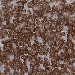 Phospholipase A2 XII Antibody, Novus Biologicals 0.1mL; Unlabeled:Antibodies,