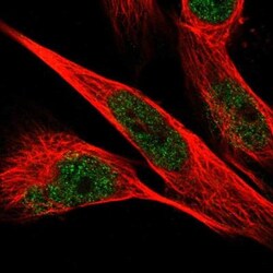 Phospholipase C delta 1 Antibody, Novus Biologicals:Antibodies:Primary
