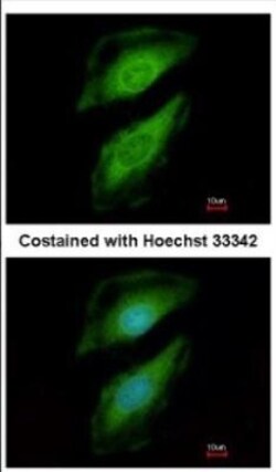 Phospholipase C delta 1 Antibody, Novus Biologicals 0.1mL; Unlabeled:Antibodies,