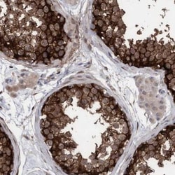 Phospholipase C delta 1 Antibody, Novus Biologicals:Antibodies:Primary