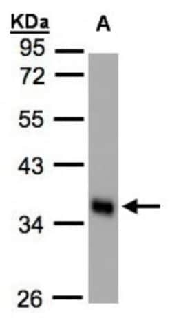 Phospholipid Scramblase 1/PLSCR1 Antibody, Novus Biologicals 0.1mL; Unlabeled:Antibodies,