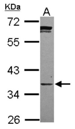 Phosphopantothenate-cysteine ligase Antibody, Novus Biologicals 0.1mL;