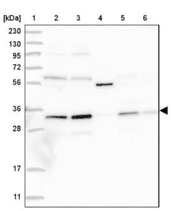 Phosphopantothenate-cysteine ligase Antibody, Novus Biologicals:Antibodies:Primary
