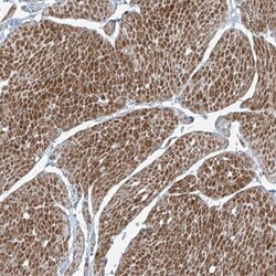 Phosphopantothenate-cysteine ligase Antibody, Novus Biologicals:Antibodies:Primary