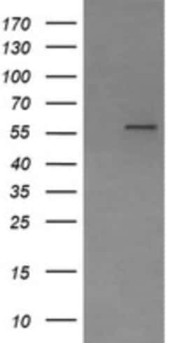Phosphoribosyl Pyrophosphate Amidotransferase Antibody (OTI1B11), Novus Biologicals 0.1 mL | Buy Online | Novus Biologicals | Fisher Scientific