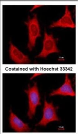Phosphoribosyl Pyrophosphate Amidotransferase Antibody, Novus Biologicals