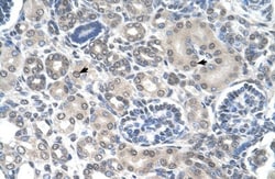 Phosphoribosyl Pyrophosphate Amidotransferase Antibody, Novus Biologicals