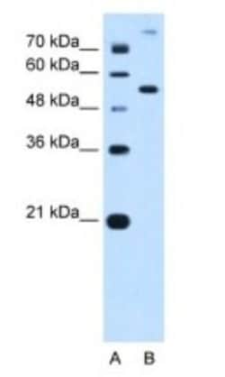 Phosphoribosyl Pyrophosphate Amidotransferase Antibody, Novus Biologicals