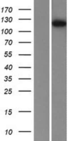 Novus Biologicals&trade;&nbsp;Phosphorylase B Overexpression Lysate