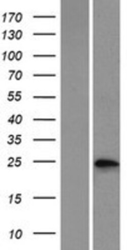 Novus Biologicals&trade;&nbsp;Phosphoserine phosphatase Overexpression Lysate