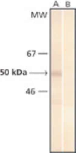 Phosphoserine Antibody (PSR-45), Novus Biologicals 0.1mL; Unlabeled:Antibodies,