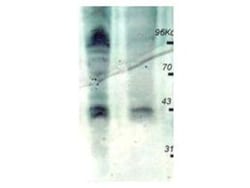 Phosphothreonine Antibody, HRP, Novus Biologicals 0.1 mg | Buy Online | Novus Biologicals | Fisher Scientific