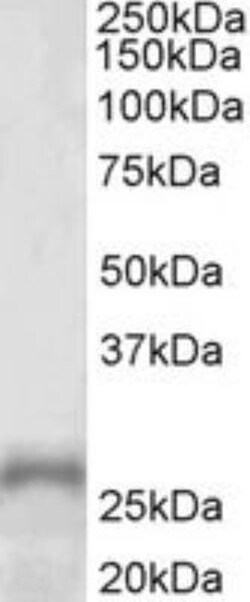 PHOX2A Antibody, Novus Biologicals 0.1mg; Unlabeled:Antibodies, Polyclonal