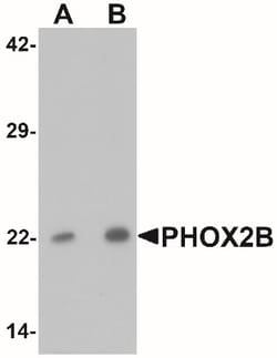 PHOX2B Antibody - BSA Free, Novus Biologicals 0.1mg; Unlabeled:Antibodies,