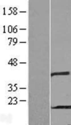 Novus Biologicals&trade;&nbsp;PHPT1 Overexpression Lysate