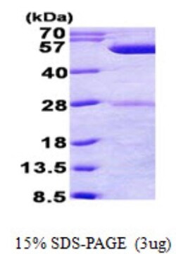 Novus Biologicals&trade;&nbsp;Recombinant E. coli phrB His Protein
