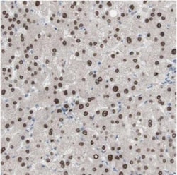 PHTF2 Antibody, Novus Biologicals 25 &mu;L, Unlabeled:Antibodies, Polyclonal
