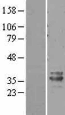 Novus Biologicals&trade;&nbsp;PHYHD1 Overexpression Lysate