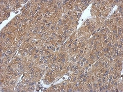 PHYHIP Antibody, Novus Biologicals 0.1mL; Unlabeled:Antibodies, Polyclonal