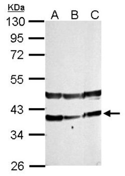 PHYHIP Antibody, Novus Biologicals 0.1mL; Unlabeled:Antibodies, Polyclonal