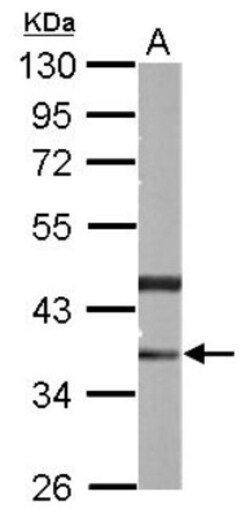 PHYHIP Antibody, Novus Biologicals 0.1mL; Unlabeled:Antibodies, Polyclonal
