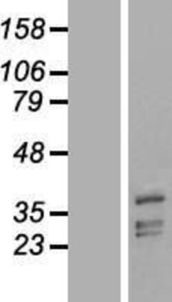 Novus Biologicals&trade;&nbsp;PHYHIP Overexpression Lysate
