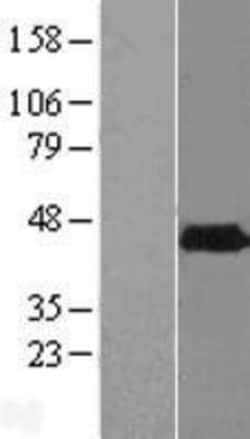 Novus Biologicals&trade;&nbsp;PHYHIPL Overexpression Lysate