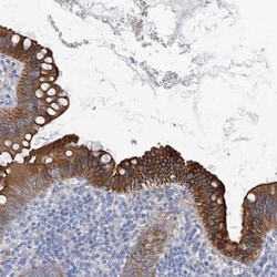 DBR1 Antibody, Novus Biologicals:Antibodies:Primary Antibodies