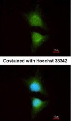 anti-PI 3-Kinase p110 beta/PIK3CB, Polyclonal, Novus Biologicals 0.1mg;
