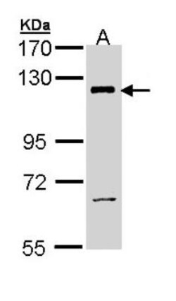 anti-PI 3-Kinase p110 beta/PIK3CB, Polyclonal, Novus Biologicals 0.1mg;