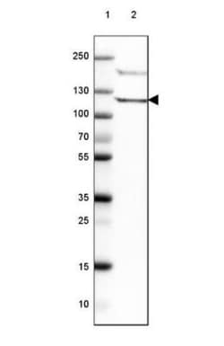 PI 3-Kinase p110 delta Antibody, Novus Biologicals 0.1mL; Unlabeled:Antibodies,